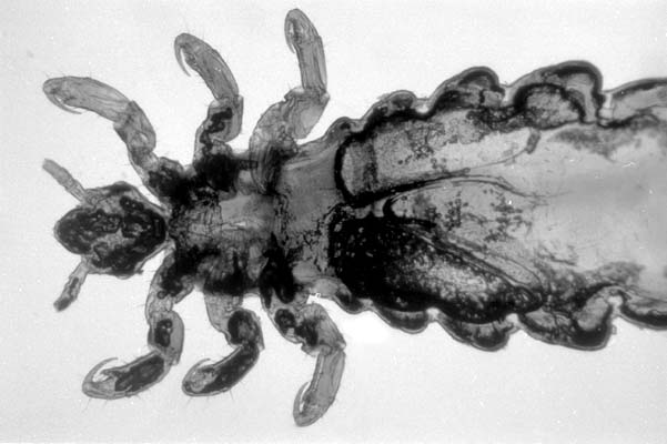 louse